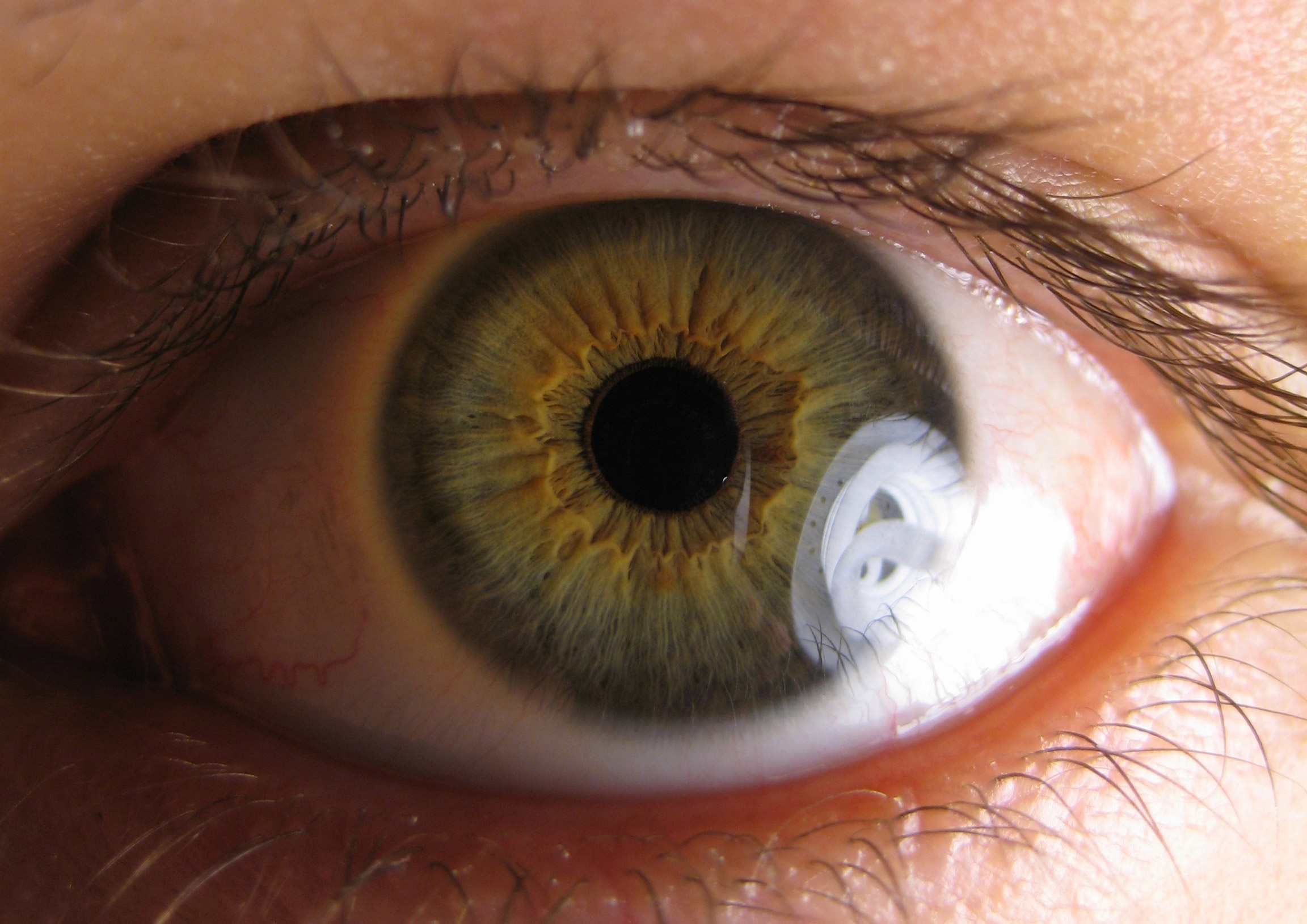 El 4,6% de los españoles padece alguna enfermedad relacionada con la retina