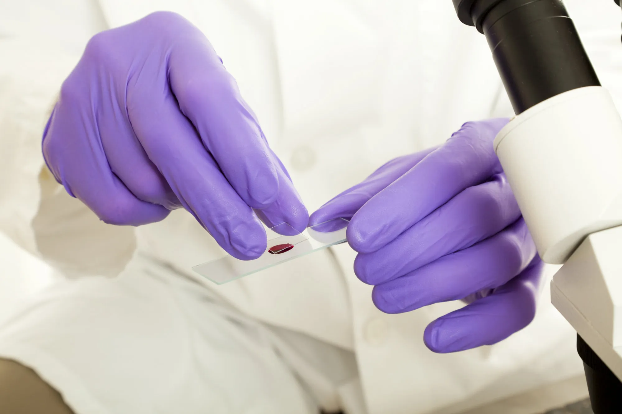 ¿Puede el ejercicio físico alterar los resultados de un análisis de sangre?