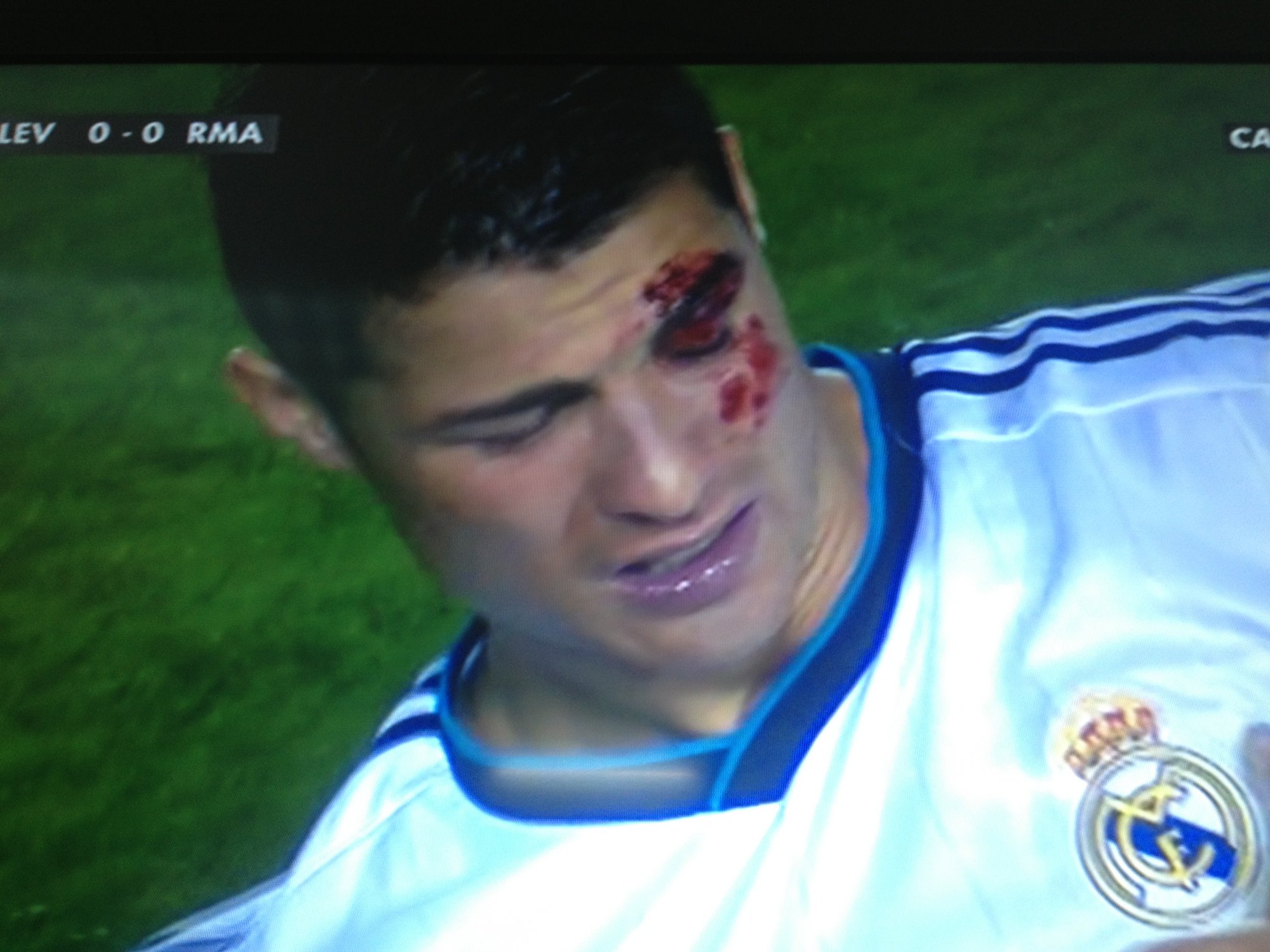 Cristiano Ronaldo perdió la visión en los dos ojos en el descanso del partido ante el Levante