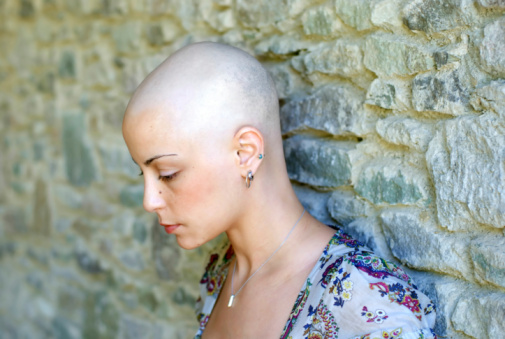 ¿Con la quimioterapia se cae siempre el pelo?