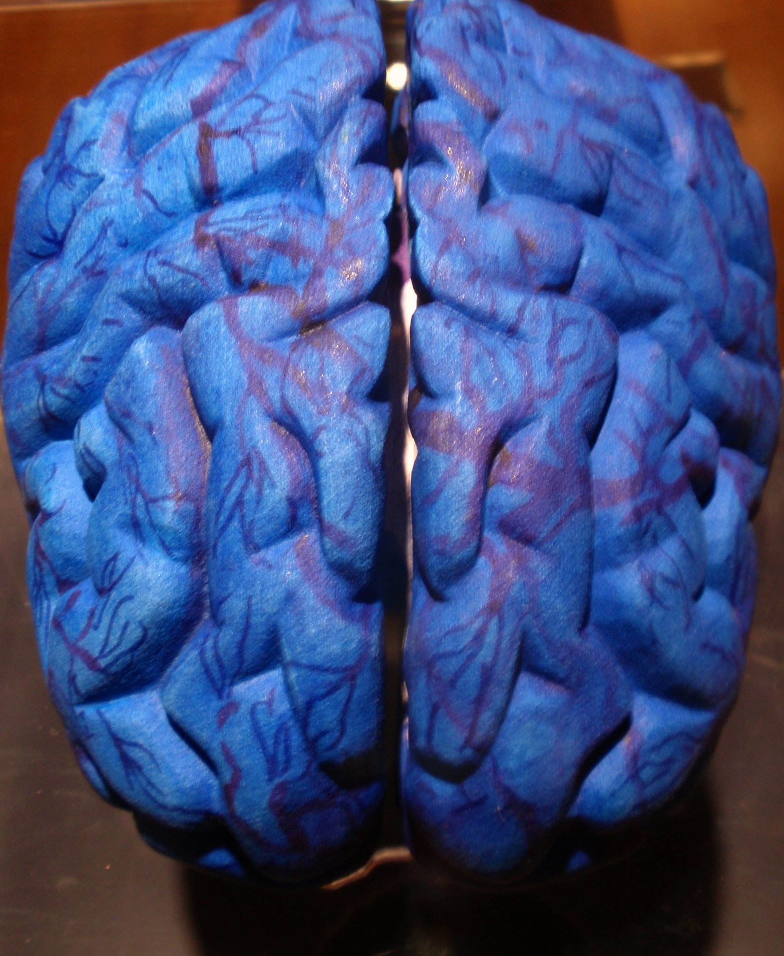 Un estudio del cerebro da una idea de la actividad de la esquizofrenia