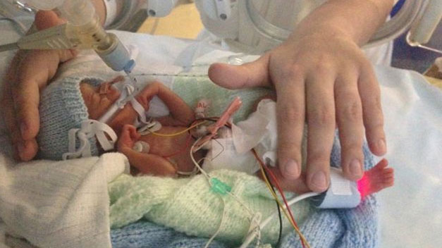 Nace Ethan, un milagro de 400 gramos y seis meses de gestación