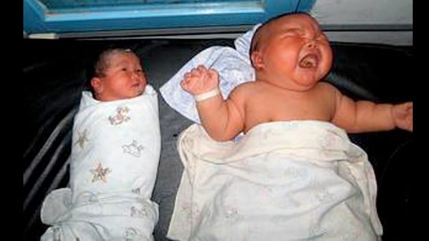 Un niño indonesio tiene el record guiness de peso al nacer ¡con 8,7 kilos!