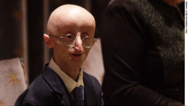 Sam Berns, un joven enfermo de progeria, muere a los 17 años