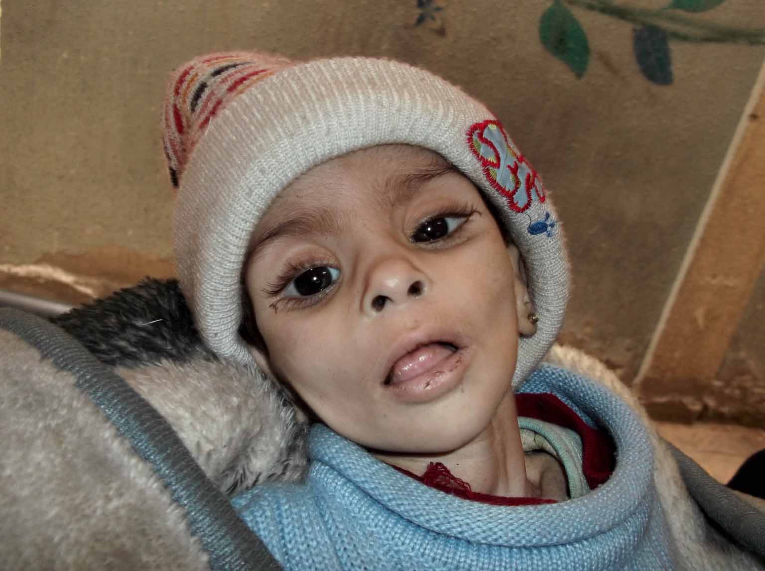 Isra al-Masri, la niña que murió de hambre en el campamento de Yamurk tras hacerle esta foto
