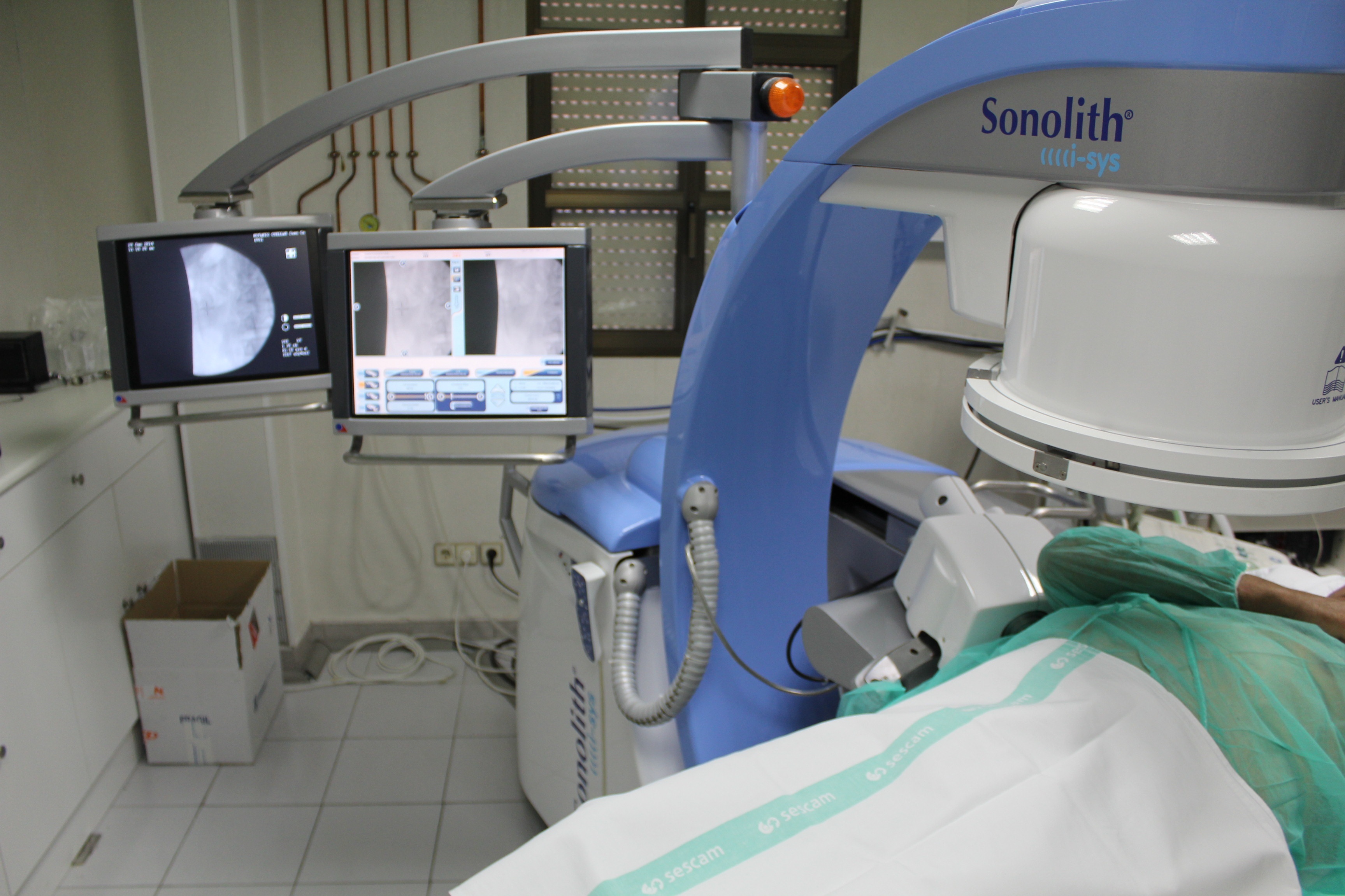 El Hospital de Toledo comienza a realizar tratamientos de fragmentación de cálculos renales con sedación