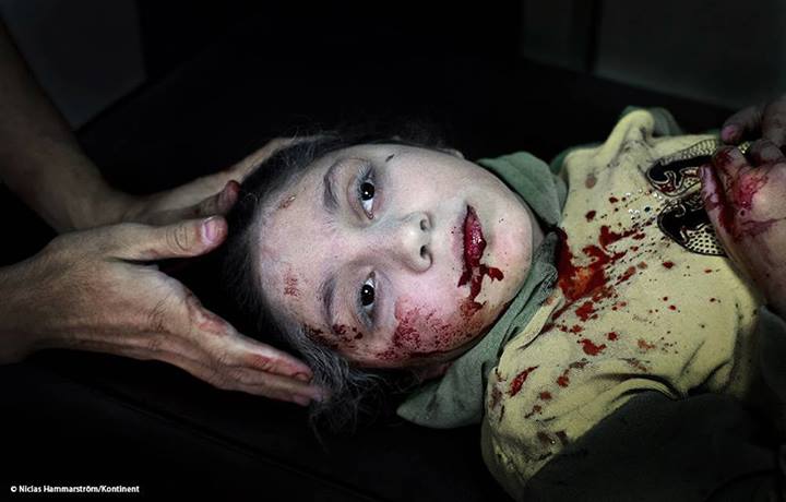 La imagen de una niña siria herida es la elegida como mejor foto de 2013 para UNICEF