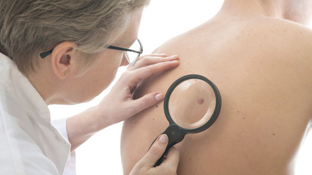 ¿Cuál es la mortalidad estimada por cáncer de piel?