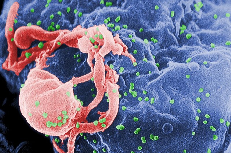 Identifican al culpable de las complicaciones de salud en el VIH