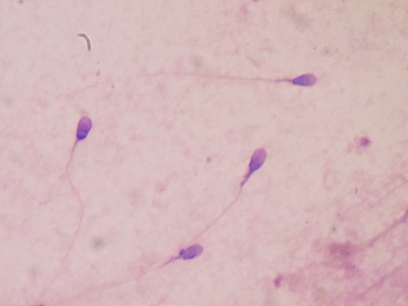 El microbioma del semen influye en la transmisión sexual del VIH