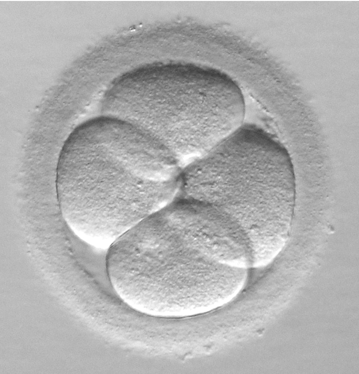 Expertos apuestan por la transferencia de un único embrión para evitar embarazos múltiples no deseados