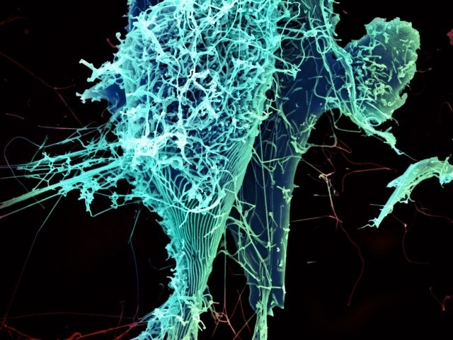 El riesgo de propagación del virus del ébola en España es «extremadamente bajo»