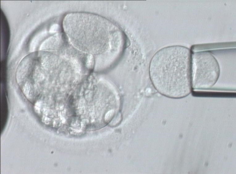 La técnica CGHarray analiza embriones y mitiga efectos negativos de embarazos de mujeres mayores