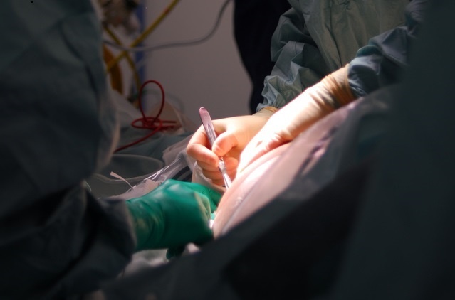 La espera media para operarse en los hospitales del Sergas sube a 81,5 días, uno más que al cierre de septiembre de 2013
