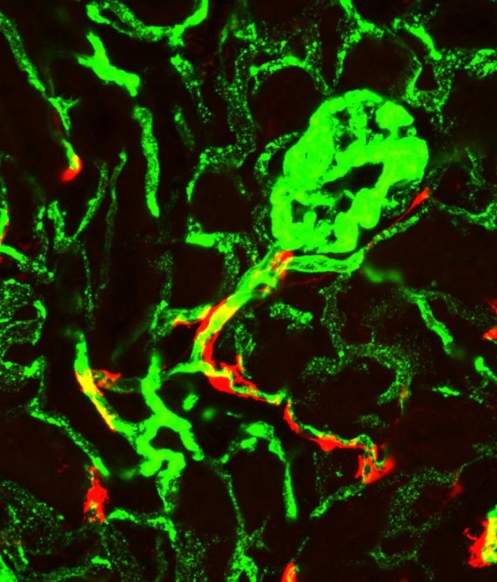 Identificadas unas raras células madre que dan lugar a la fibrosis