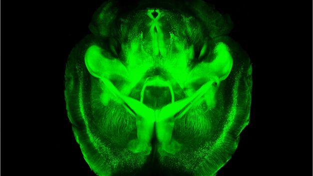 Los engaños del cerebro que todos sufrimos