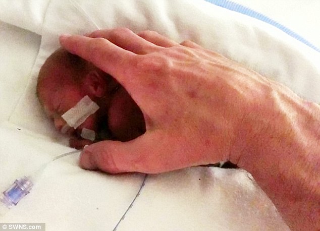 Jett Morris, el niño calificado como «feto no viable», cumple un año de edad