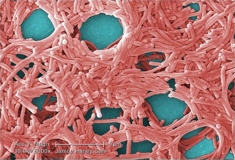 Se »escapa» una bacteria mortal en un laboratorio de alta seguridad de EEUU