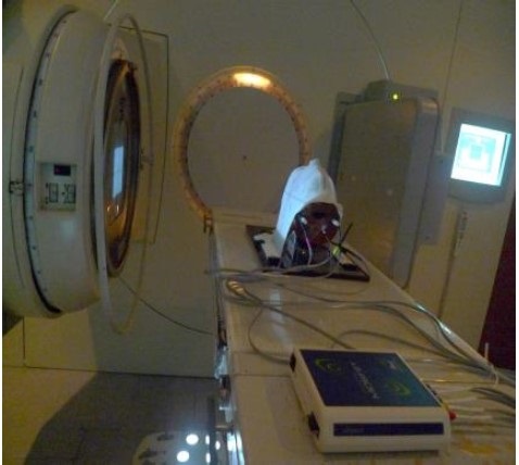 Investigadores de la UPV desarrollan un nuevo método para personalizar los tratamientos de radioterapia
