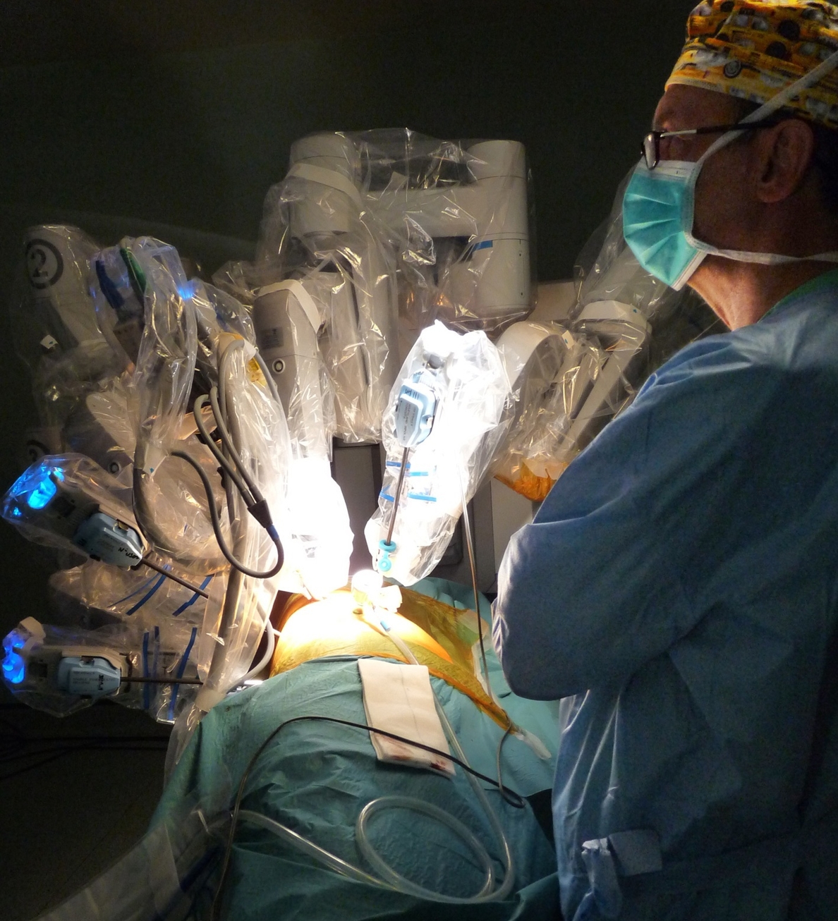 Primera extracción en España de un tumor pulmonar marcado con radiotrazador a través del robot quirúrgico »Da Vinci»