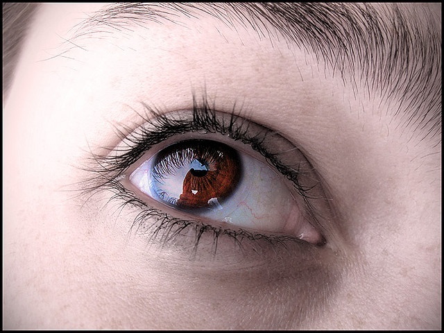 El análisis del fondo del ojo ayuda a diagnosticar rápidamente el estado y evolución de la esquizofrenia