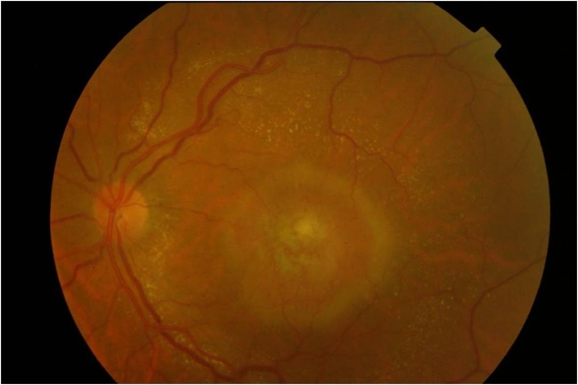 Crean células de la retina a partir de células madre para tratar la degeneración macular asociada a la edad