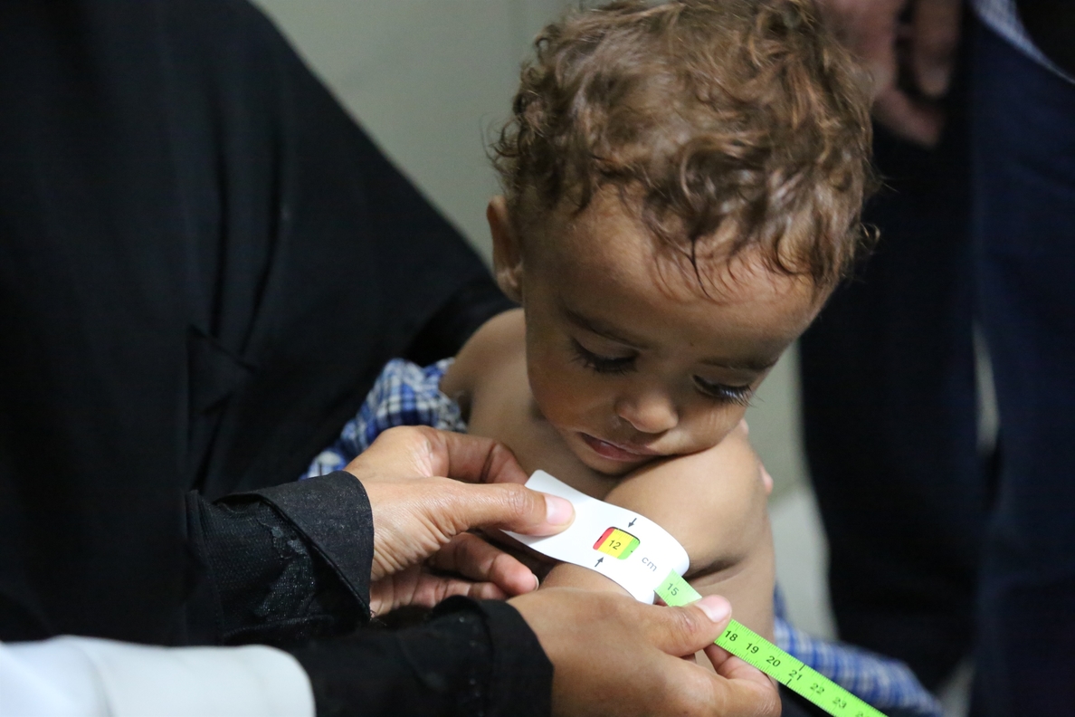 El PMA da la voz de alarma ante el aumento del hambre y la malnutrición en Yemen