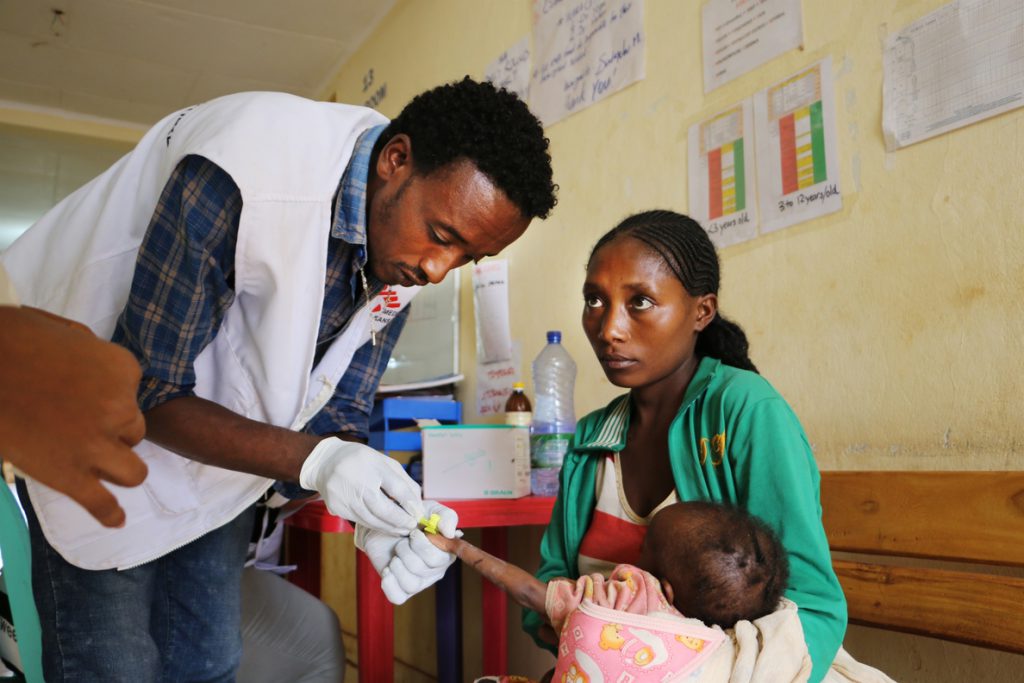 Los niveles de desnutrición en el sur de Etiopía llegan a niveles «alarmantes», según alerta MSF