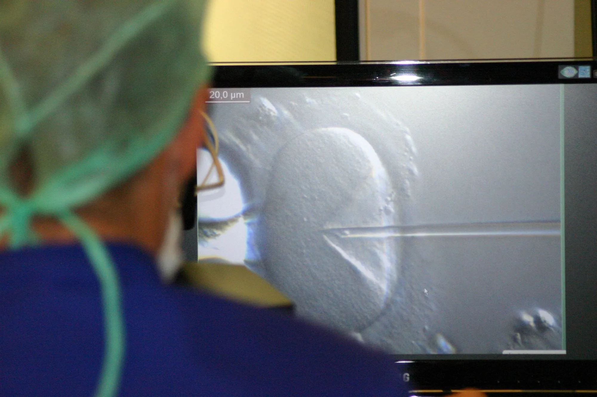 Las incertidumbres en torno a la COVID-19 aconsejan tomar medidas para preservar la fertilidad
